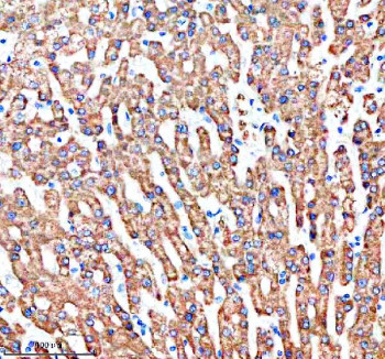 Anti-SHARPIN / SHANK-associated RH domain-interacting protein