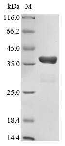 CREB-binding protein (CREBBP), partial, human, recombinant