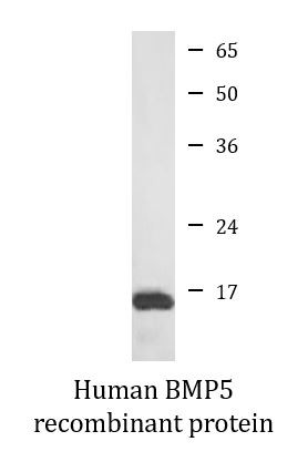 Human BMP5 recombinant protein (Active)