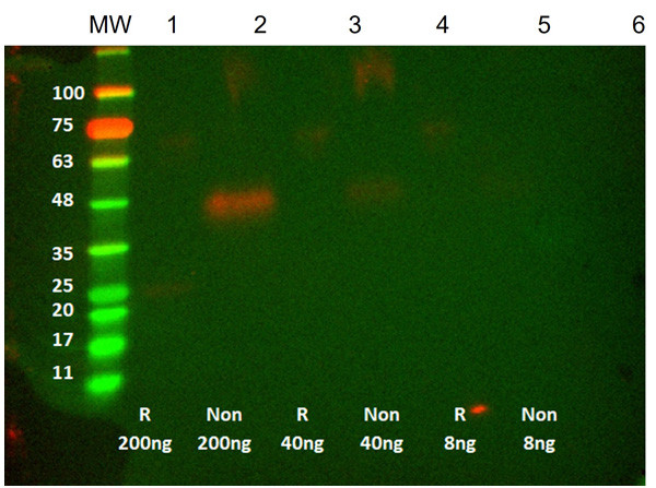 Anti-VEGF RTH258 [Recombinant scFv Antibody]