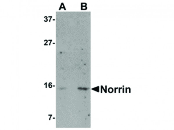 Anti-Norrin