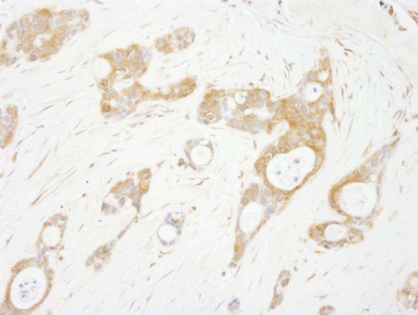 Anti-OSR1 (IHC)