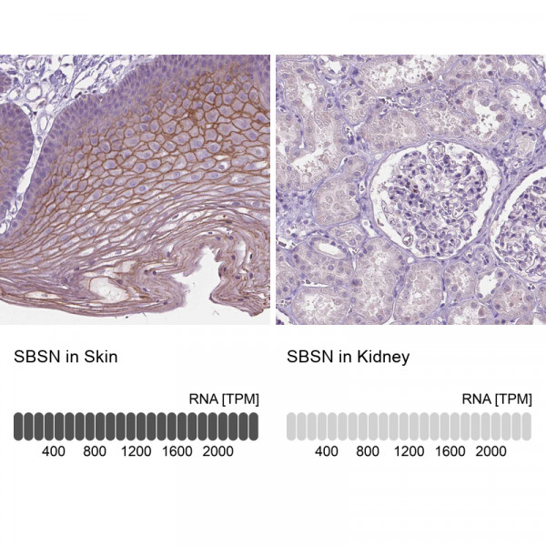 Anti-SBSN