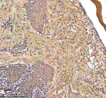Anti-Zebrafish Hbae1.1 / Hemoglobin alpha embryonic 1.1