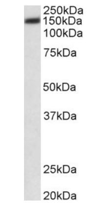 Anti-ATP2B1 / PMCA1