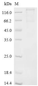 Coiled-coil domain containing 112 (Ccdc112), recombinant rat