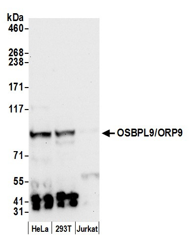 Anti-OSBPL9/ORP9