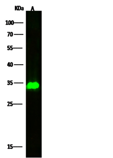 Anti-Pancreasin/Marapsin/PRSS27 Monoclonal Recombinant Antibody