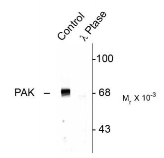 Anti-phospho-PAK1 / PAK2 / PAK3 (Thr402)
