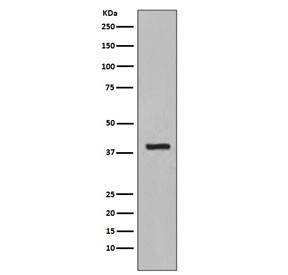 Anti-KRT19 / Cytokeratin 19, clone CCO-11