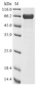 Nucleoprotein (N), Bat coronavirus HKU9, recombinant