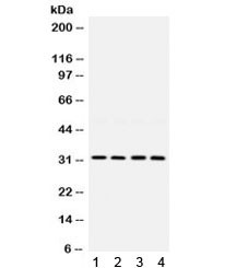 Anti-LOX / Lysyl Oxidase