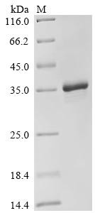 Protein mono-ADP-ribosyltransferase PARP16 (PARP16), partial, recombinant human