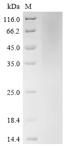 Protein UL16 (UL16), partial, human cytomegalovirus, recombinant