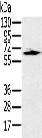 Anti-HSF2