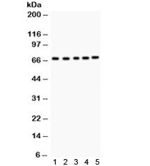 Anti-Acetylcholinesterase / ACHE