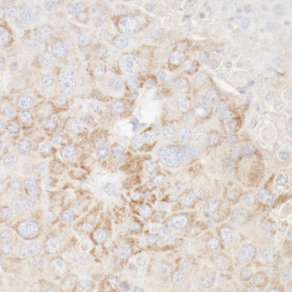 Anti-ATP5A1