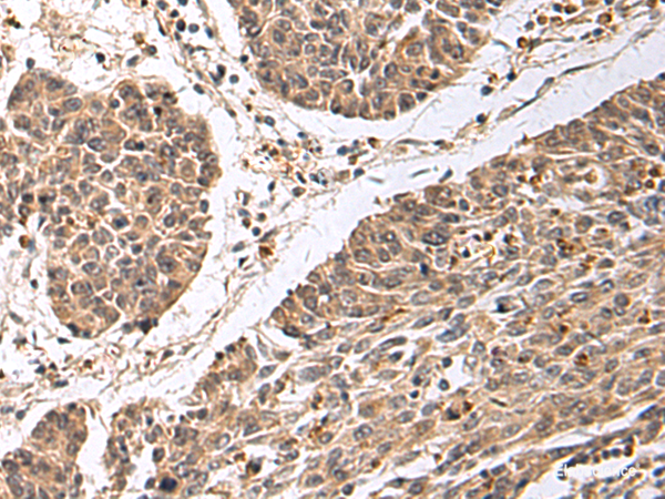 Anti-CD24