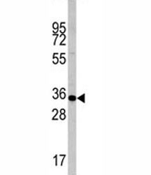 Anti-Caspase-6