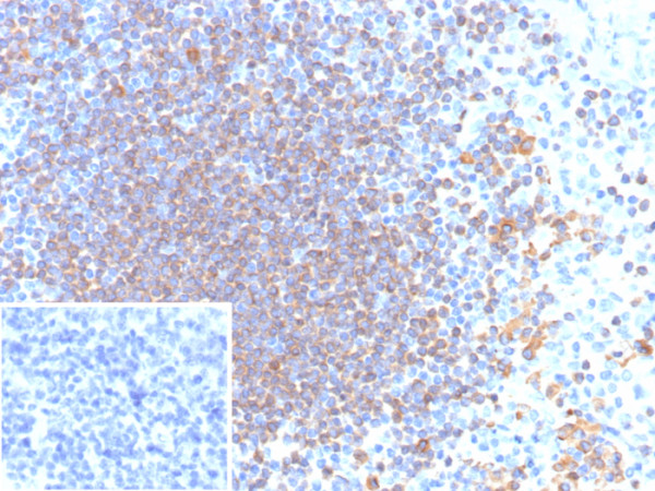 Anti-CD79a (B-Cell Marker), recombinant antibody, clone rIGA/6986