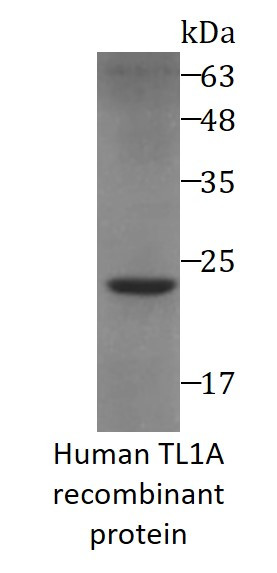 Human TL1A recombinant protein (Active) (His-tagged)