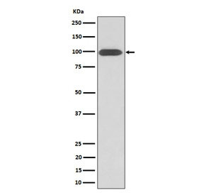Anti-Integrin beta 3 / ITGB3, clone 29I49