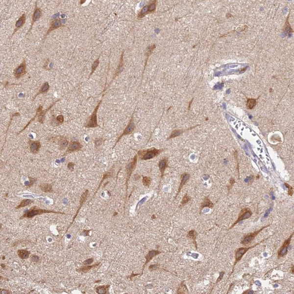 Anti-BSCL2