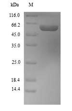 Aldehyde dehydrogenase 1A1 (Aldh1a1), mouse, recombinant