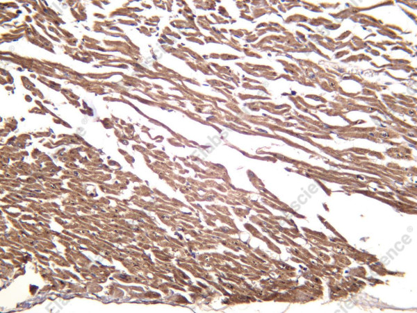 Anti-Recombinant alpha 1a Adrenergic Receptor, clone C112419