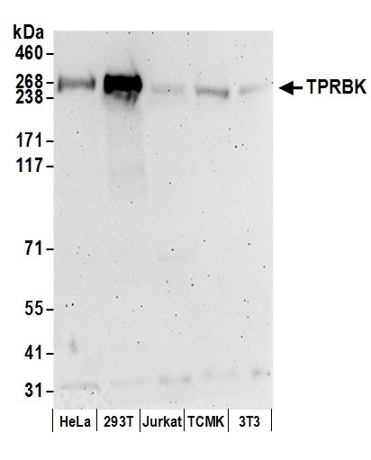 Anti-TPRBK