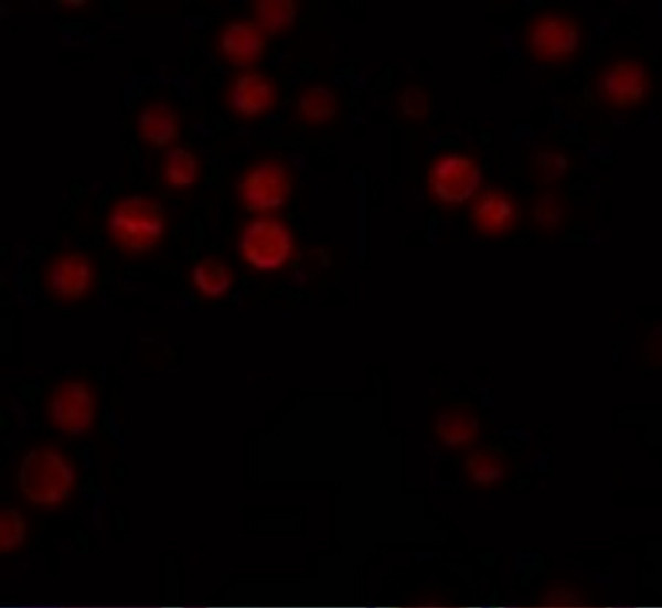 Anti-ATG9B