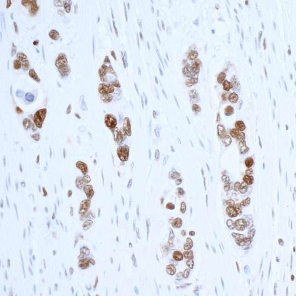 Anti-PCNA Recombinant Monoclonal