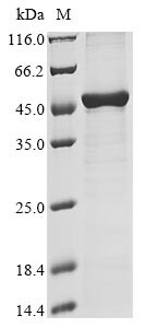 HLA class I histocompatibility antigen, A alpha chain (HLA-A),partial, human, recombinant