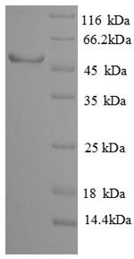 Sialidase-3 (NEU3), partial, human, recombinant