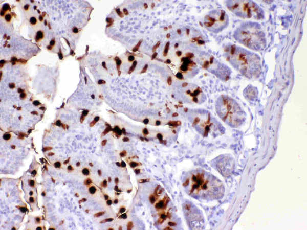 Anti-TFF3 / Trefoil factor 3