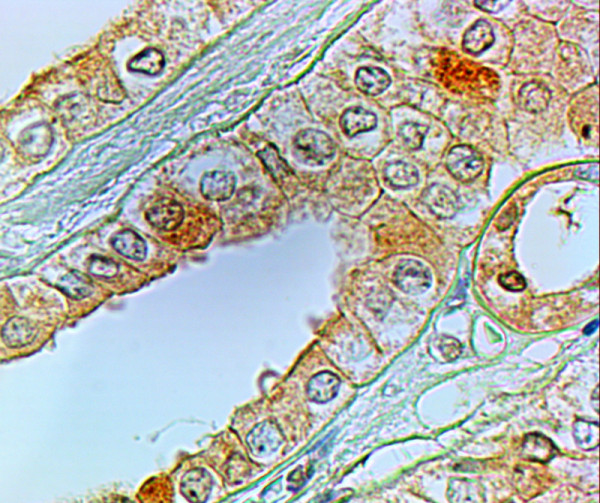 Anti-EP1 receptor / PTGER1, Internal