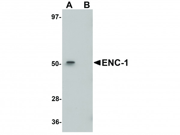 Anti-ENC-1