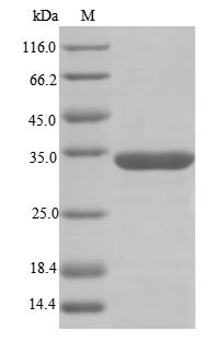 RNA-binding motif protein, X chromosome (RBMX),partial, human, recombinant
