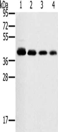 Anti-PTGER1