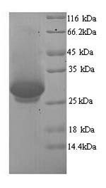 Dynamin-1 (DNM1), partial, human, recombinant