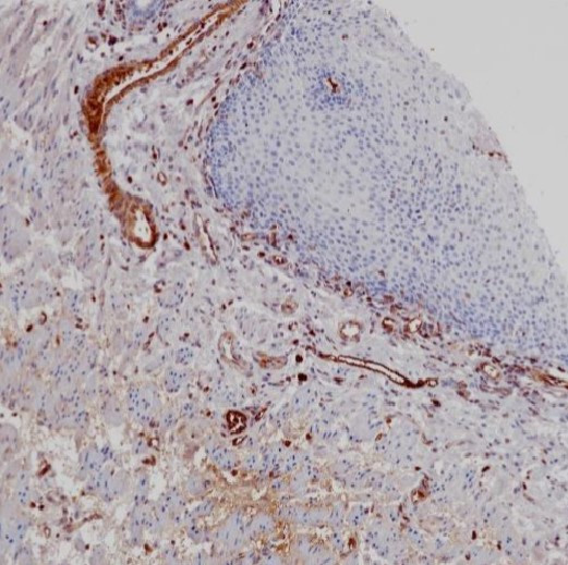 Anti-HBA1 / Hemoglobin Subunit Alpha 1, clone SQab30355