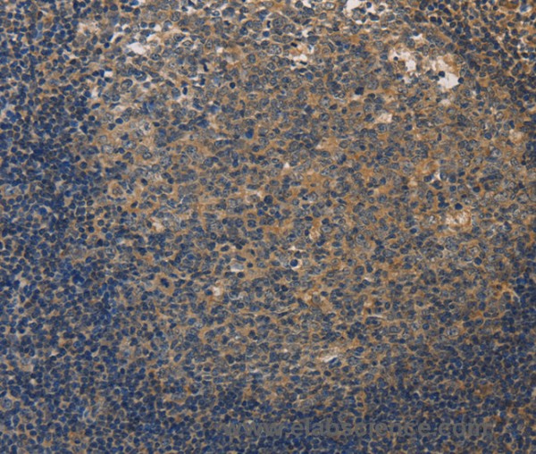 Anti-DUSP26