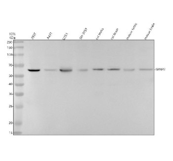 Anti-SENP2 / Small ubiquitin-related modifier 1, clone 24S77