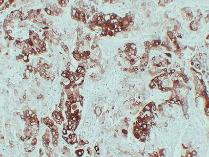 Anti-Cytokeratin 6