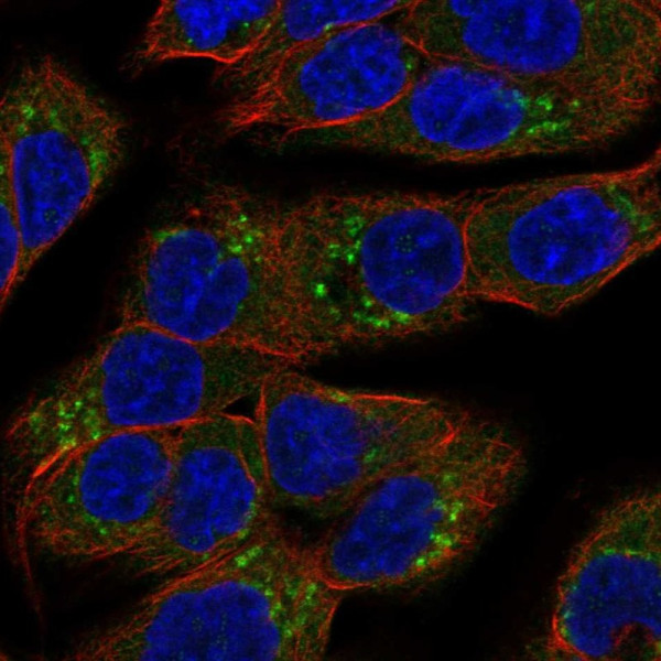 Anti-SCYL3
