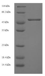 H-2 class I histocompatibility antigen, D-D alpha chain (H2-D1),partial, mouse, recombinant
