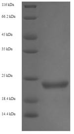 Shiga-like toxin 1 subunit B (stxB), Enterobacteria phage H19B, recombinant