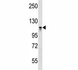 Anti-Dnmt3a Antibody