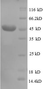 CD320 antigen (CD320), partial, recombinant human
