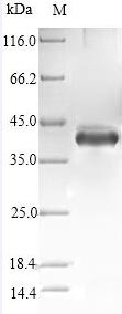 Stanniocalcin-1 (STC1), partial, human, recombinant